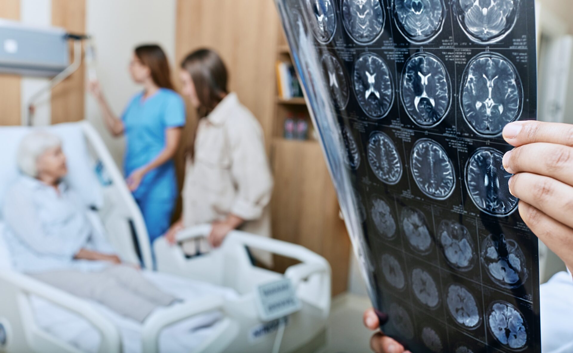 How a Stroke Malpractice Attorney Can Help After a Misdiagnosis in New York